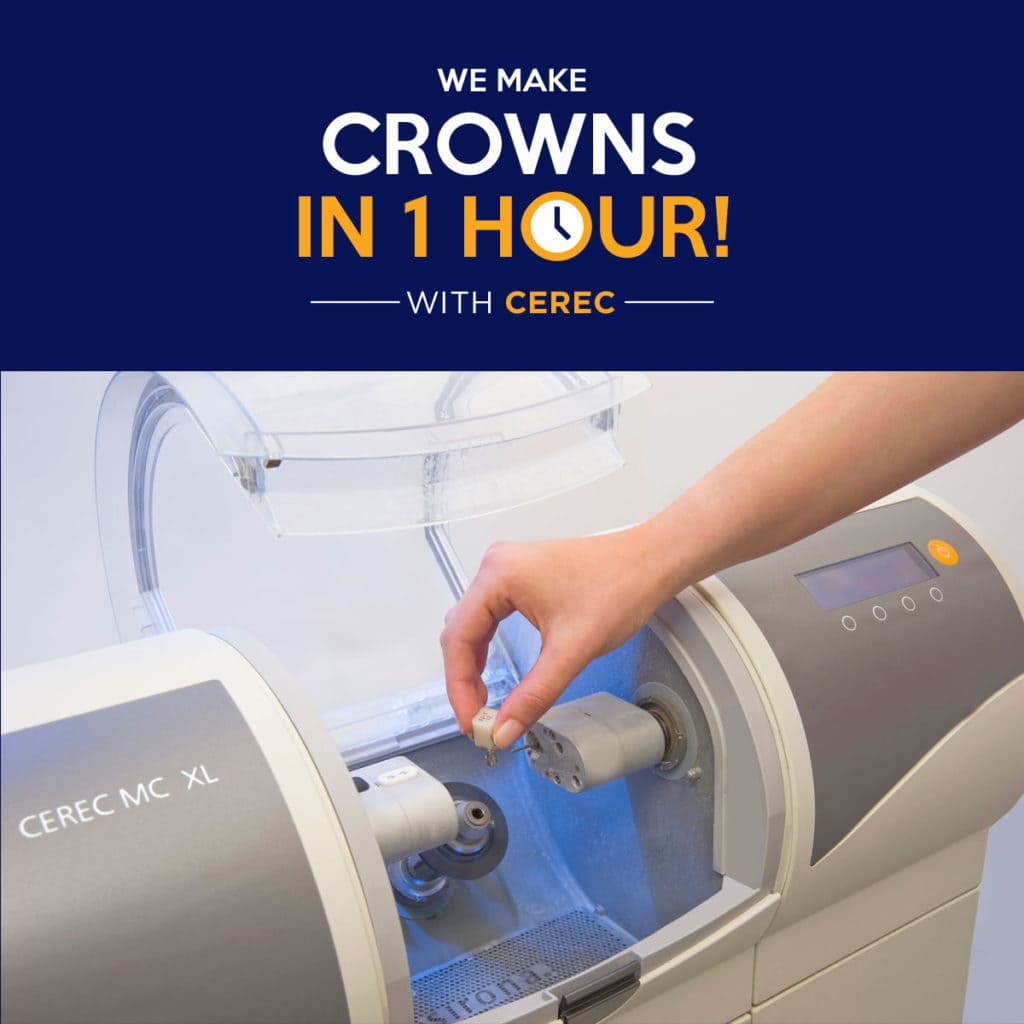 crowns, CEREC, family dentist, rochester hills, oakland county, dentist, pediatric dentistry,