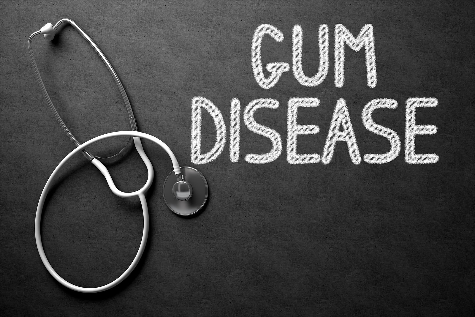 9 Signs That Indicate You May Need Dental Implants