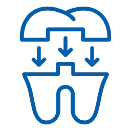 Composite Fillings