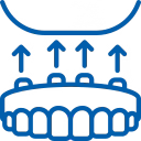 Supporting a Full Arch