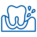 Why Gum Support Matters